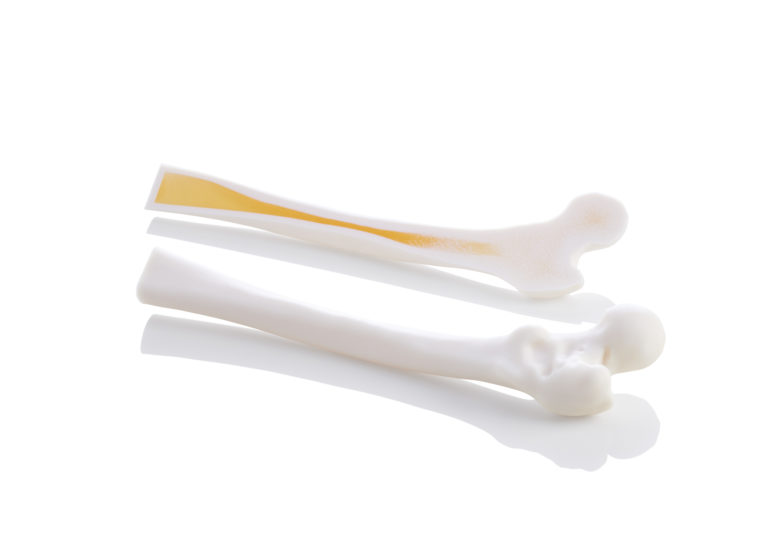 Stratasys 3D Printed Medical Models Help Address Surgical Training Challenges 27 Femur Pair